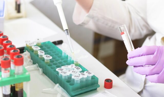 laboratory, medical, medicine, hand, research, lab, test, doctor, equipment, scientist, woman, chemistry, science, hospital, experiment, person, technician, technology, healthcare, working, health, tube, work, research lab, blood samples, laboratory, lab, lab, scientist, scientist, scientist, scientist, scientist