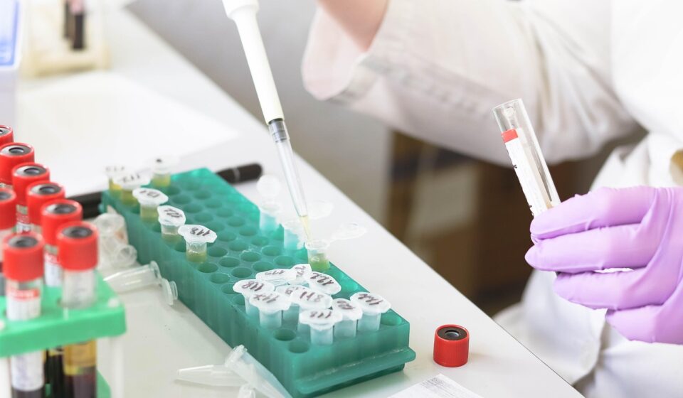 laboratory, medical, medicine, hand, research, lab, test, doctor, equipment, scientist, woman, chemistry, science, hospital, experiment, person, technician, technology, healthcare, working, health, tube, work, research lab, blood samples, laboratory, lab, lab, scientist, scientist, scientist, scientist, scientist