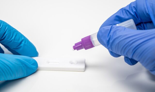 corona, coronavirus, covid, laboratory, medical, lab, health, laboratory, laboratory, lab, lab, lab, lab, lab