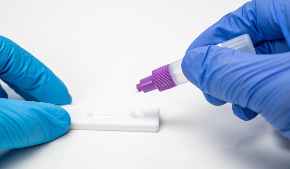 corona, coronavirus, covid, laboratory, medical, lab, health, laboratory, laboratory, lab, lab, lab, lab, lab