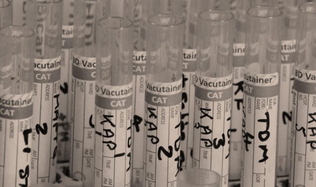 test, tube, lab, nature, medical, research, water, clinical, health, chemistry, experiment, stick, pharmaceutical, liquid, pharmacology, laboratory, chemical, analysis, medicine, biology, glassware, microbiology, pharmacy, drops, test-tube, glass, brown health, brown medical, brown glass, brown research, brown medicine, brown lab, brown test, brown glasses, brown laboratory, brown chemistry