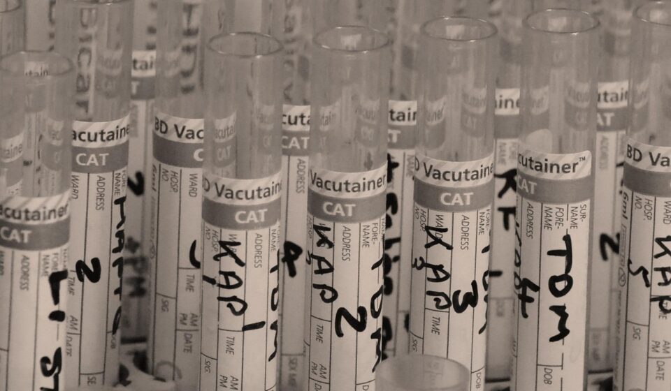 test, tube, lab, nature, medical, research, water, clinical, health, chemistry, experiment, stick, pharmaceutical, liquid, pharmacology, laboratory, chemical, analysis, medicine, biology, glassware, microbiology, pharmacy, drops, test-tube, glass, brown health, brown medical, brown glass, brown research, brown medicine, brown lab, brown test, brown glasses, brown laboratory, brown chemistry