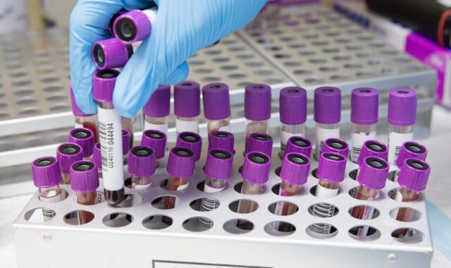 sample, lab, laboratory, scientist, medical, health, test, science, healthcare, research, tube