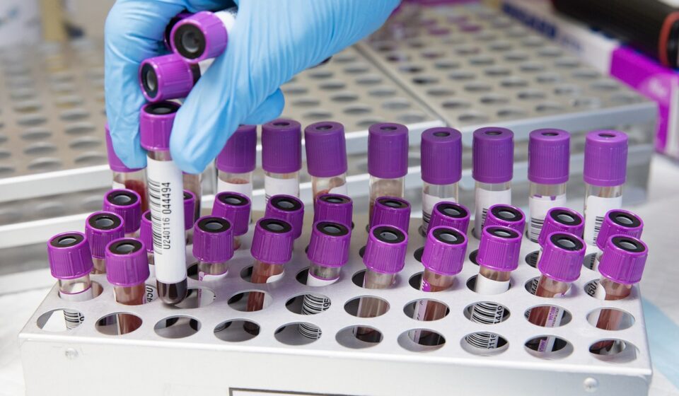 sample, lab, laboratory, scientist, medical, health, test, science, healthcare, research, tube