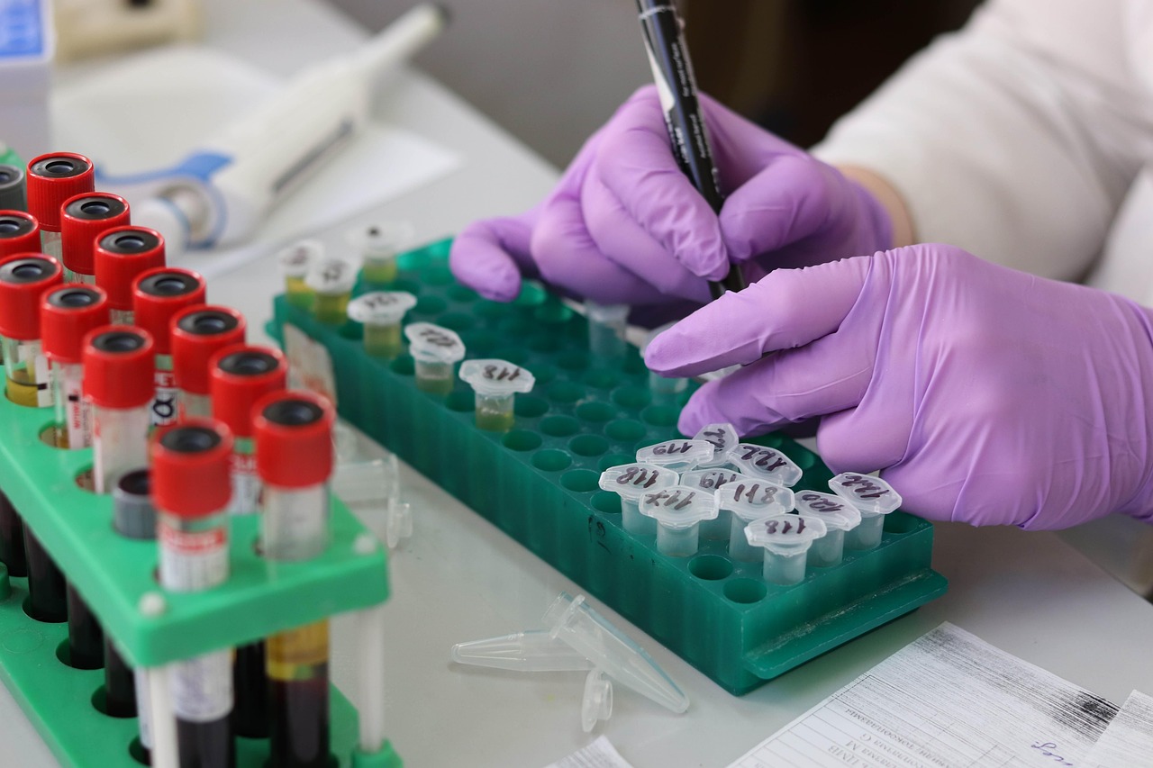 laboratory, medical, medicine, hand, research, lab, test, doctor, equipment, scientist, woman, chemistry, science, hospital, experiment, person, technician, technology, healthcare, working, health, tube, work, research lab, blood samples, laboratory, laboratory, lab, lab, lab, lab, lab, scientist