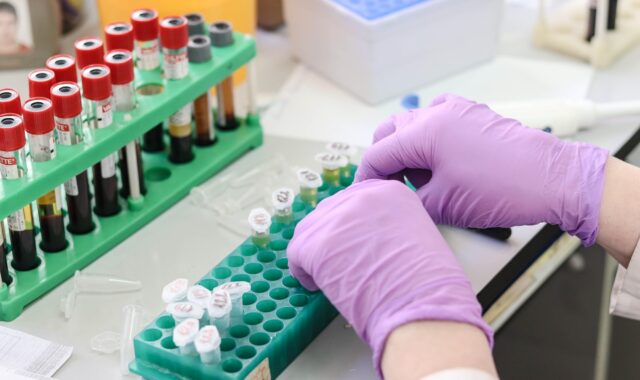 laboratory, medical, medicine, hand, research, lab, test, doctor, equipment, scientist, woman, chemistry, science, hospital, experiment, person, technician, technology, healthcare, working, health, tube, work, research lab, blood samples, laboratory, laboratory, laboratory, laboratory, laboratory, lab, lab, lab, scientist