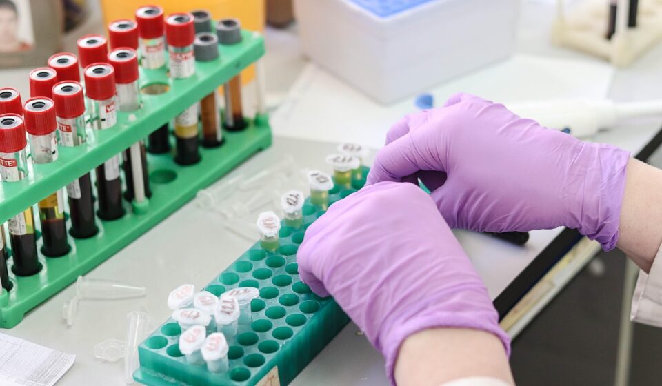 laboratory, medical, medicine, hand, research, lab, test, doctor, equipment, scientist, woman, chemistry, science, hospital, experiment, person, technician, technology, healthcare, working, health, tube, work, research lab, blood samples, laboratory, laboratory, laboratory, laboratory, laboratory, lab, lab, lab, scientist