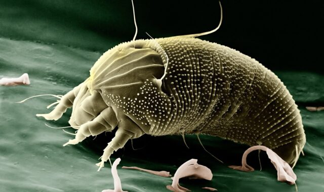 mite, aceria anthocoptes, acari, arachnid, spider, electron microscope, eriophyidae, electron micrograph, enlarged, electron microscopy, science, allergy, allergen, krankheitenserreger, infection, disease, mite, mite, spider, spider, science, science, science, science, science, allergy, disease