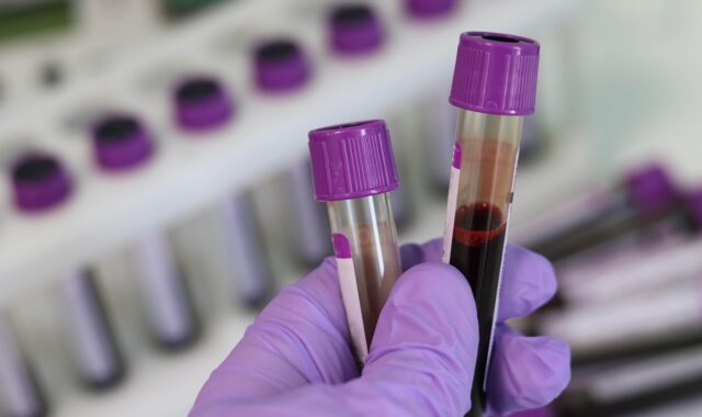 laboratory, medical, medicine, hand, research, lab, test, doctor, equipment, scientist, woman, chemistry, science, hospital, experiment, person, technician, technology, healthcare, working, health, tube, work, research lab, blood samples, laboratory, laboratory, laboratory, laboratory, lab, lab, lab, lab, lab