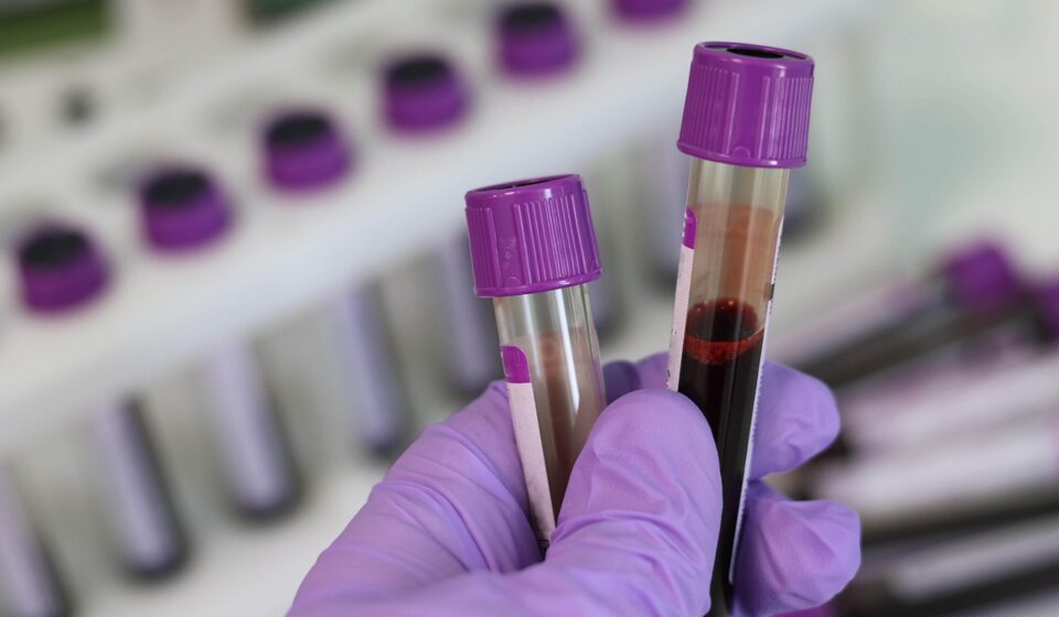laboratory, medical, medicine, hand, research, lab, test, doctor, equipment, scientist, woman, chemistry, science, hospital, experiment, person, technician, technology, healthcare, working, health, tube, work, research lab, blood samples, laboratory, laboratory, laboratory, laboratory, lab, lab, lab, lab, lab
