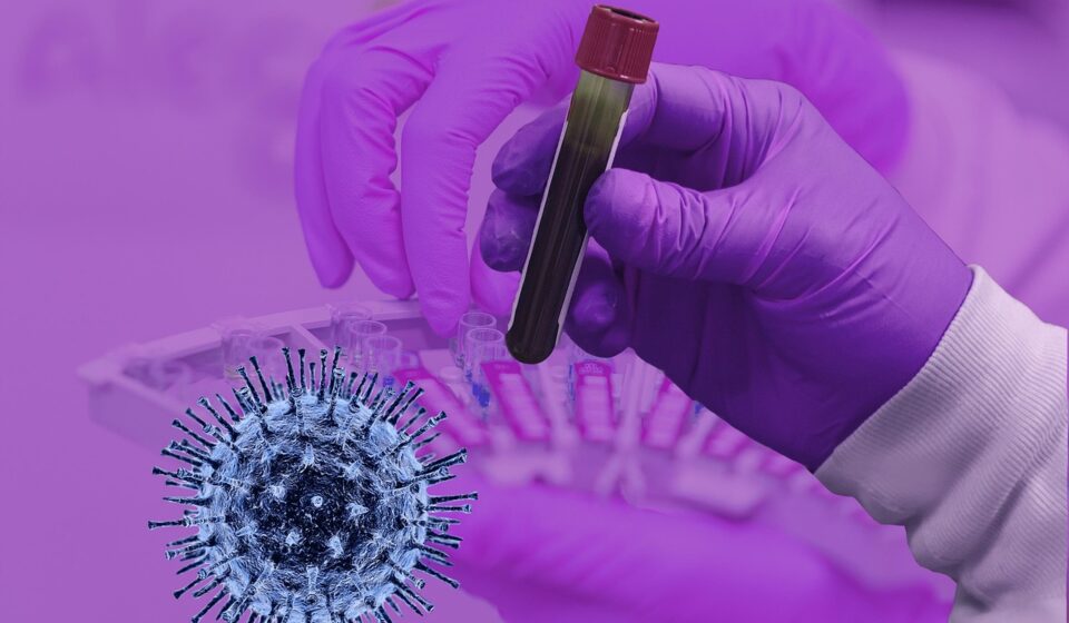 covid-19, coronavirus, epidemic, infection, exam, laboratory, medical, pathogen, corona-virus, laboratory, laboratory, laboratory, laboratory, laboratory